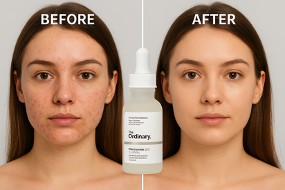 The serum in your image is The Ordinary Niacinamide 10% + Zinc 1%.

A lightweight serum that helps reduce the appearance of blemishes, congestion, and visible sebum activity. It contains niacinamide (vitamin B3) to improve